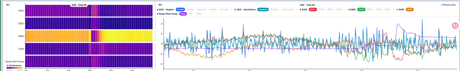 Visual Analytics — Vista B: Atención Temporal